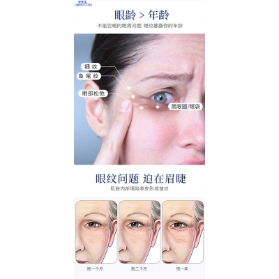 壹美(广东)药业_美容院玻尿酸微针眼贴